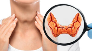 Dinh dưỡng cho bệnh suy giáp